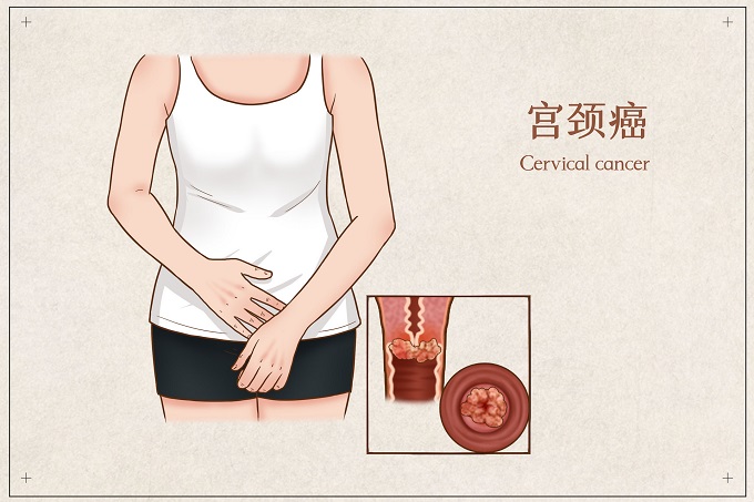 深圳九价HPV疫苗摇号最新消息(持续更新)