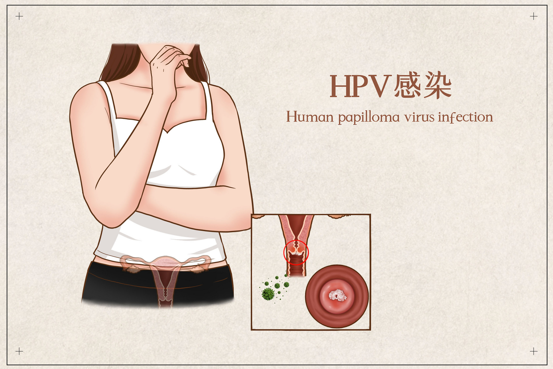 深圳hpv疫苗多少钱一针